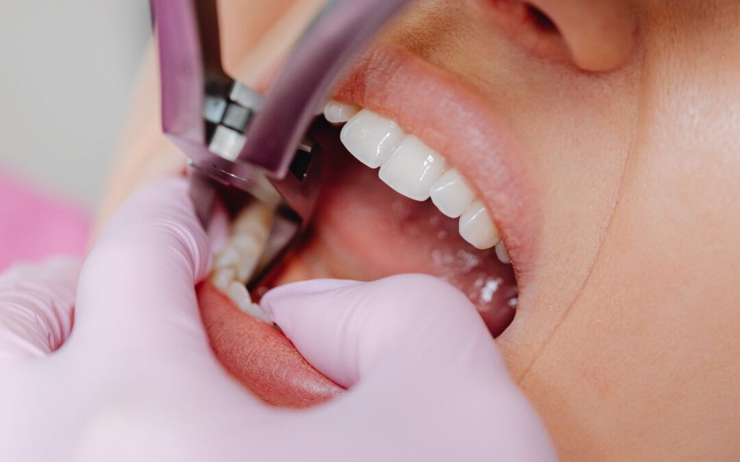 tooth extraction clinic