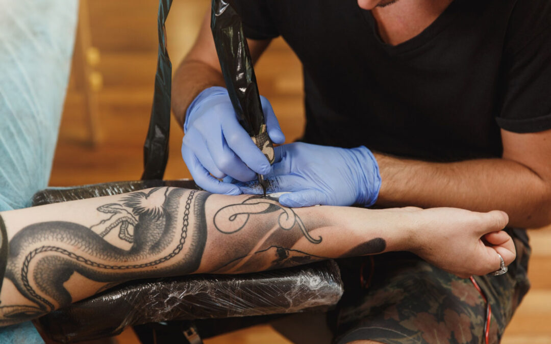 Will My Skin Look Normal After Laser Tattoo Removal in Dubai