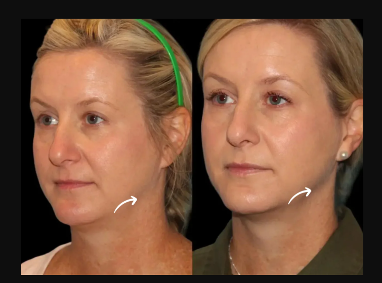Best Plastic Surgeons in dubai